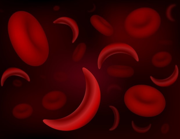 Watch Study highlights the economic burden affecting individuals with sickle cell disease – Latest News