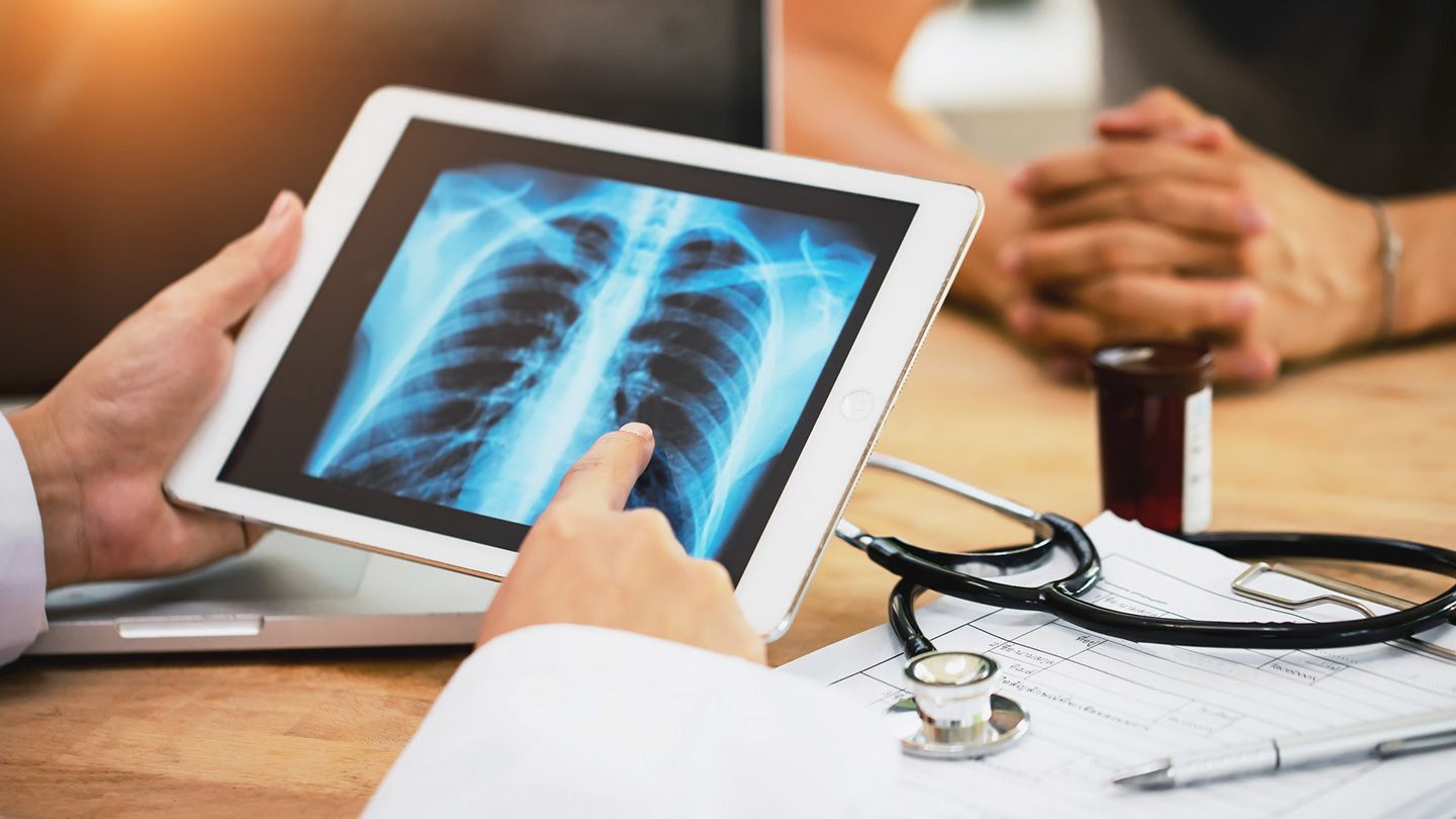 Watch Nearly Half of People With Abnormal Lung Cancer Screening Postpone Follow-Up Care – Latest News