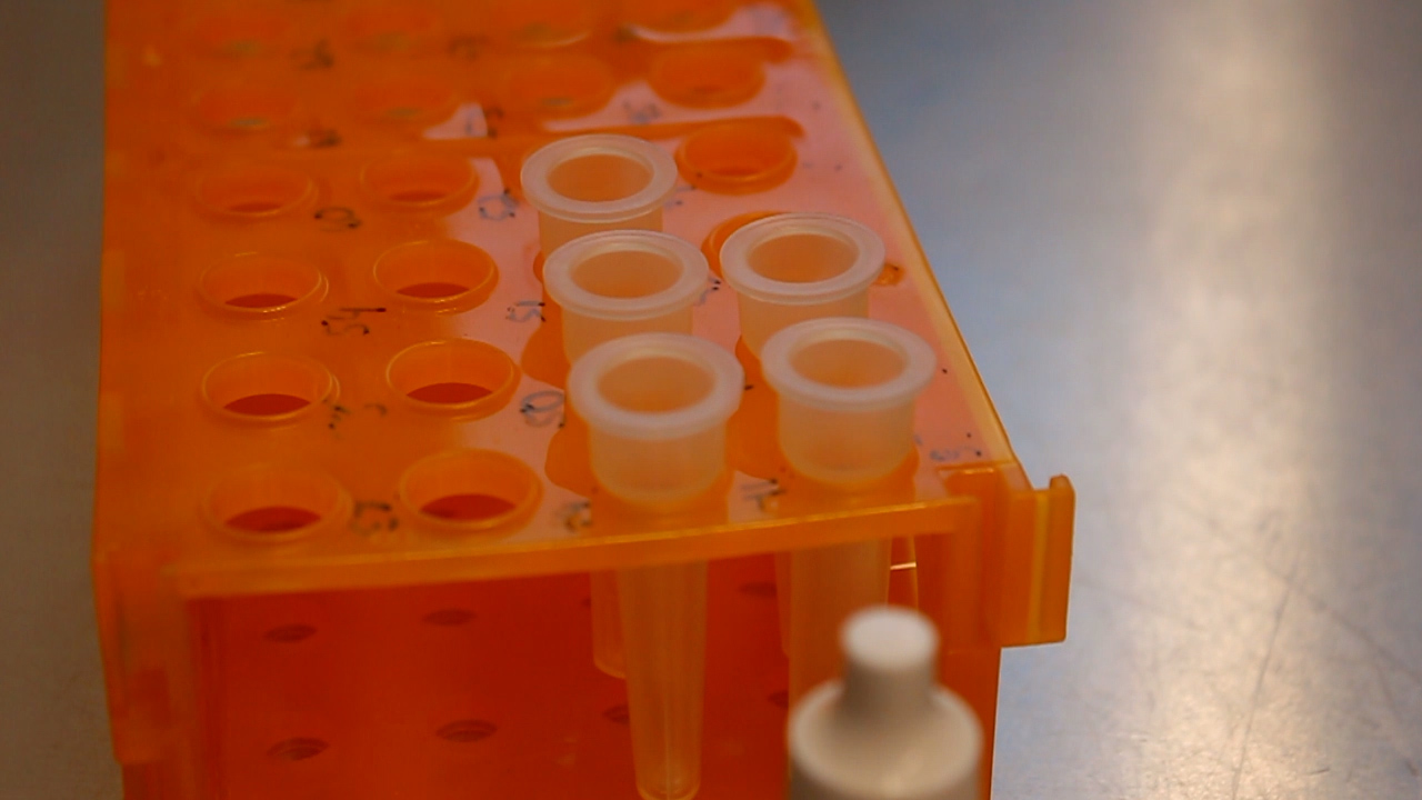 Watch ‘We’ve seen an increase’: Companies preparing to expand COVID-19 testing in Austin again – COVID-19 Latest Updates